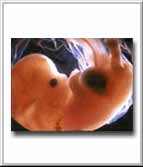 Human Embryo at 7 weeks