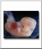 5 to 6 Week Old Embryo